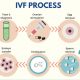 IVF PROCESS